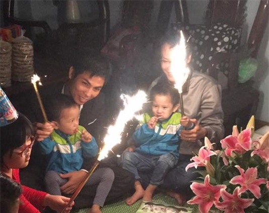 nhung hinh anh moi nhat ve cap song sinh tu tinh trung nguoi bo da mat - 11