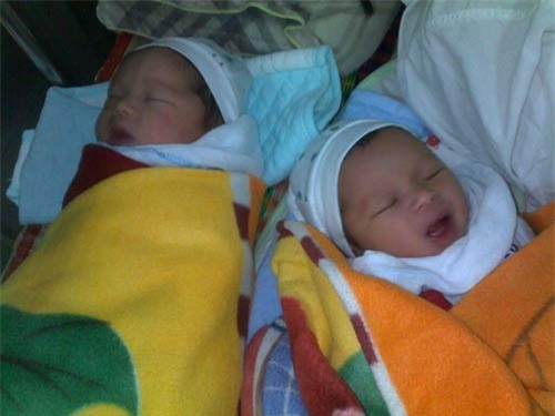 nhung hinh anh moi nhat ve cap song sinh tu tinh trung nguoi bo da mat - 2