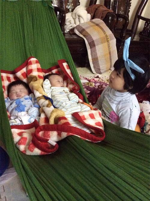 nhung hinh anh moi nhat ve cap song sinh tu tinh trung nguoi bo da mat - 3