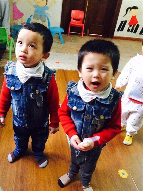 nhung hinh anh moi nhat ve cap song sinh tu tinh trung nguoi bo da mat - 4