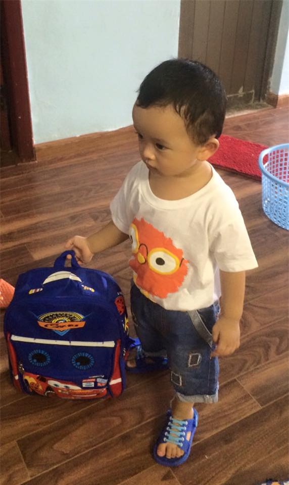 nhung hinh anh moi nhat ve cap song sinh tu tinh trung nguoi bo da mat - 5