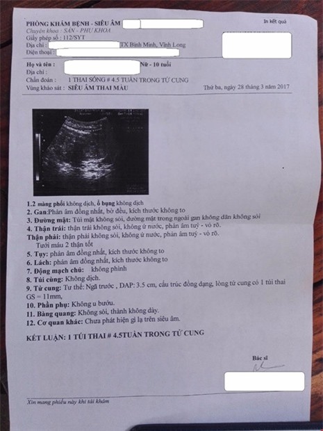 be 10 tuoi bi xam hai co thai 4,5 tuan: cong an vinh long chi dao xu ly - 2