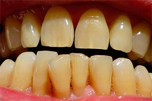 trang-rang-blogtamsuvn4