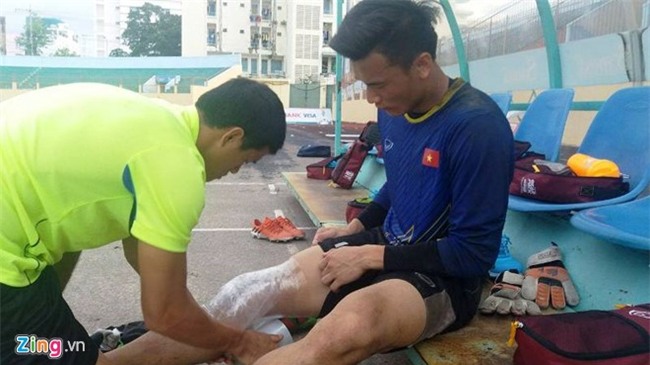 Tien Dung chan thuong, U20 Viet Nam doi dien kho khan chong chat hinh anh 2