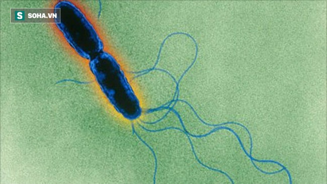 World Bank đưa tin 30-40% thịt lợn tại VN nhiễm khuẩn độc: Ăn thịt thế nào thì an toàn? - Ảnh 1.