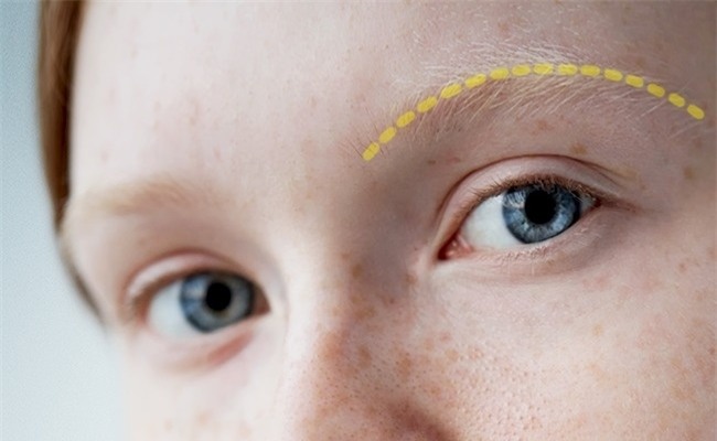 hay can than, hinh dang long may co the