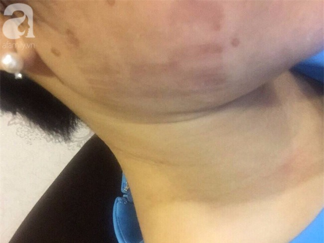 TP.HCM: Đi ăn sinh nhật, thực khách bị quản lý nhà hàng gạt tay trúng 2 cái vào mặt - Ảnh 4.