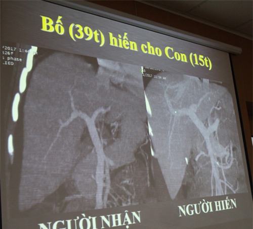 trong giay phut can ke “cua tu”, nguoi cha hien mot phan co the de giu lai su song cho con - 1