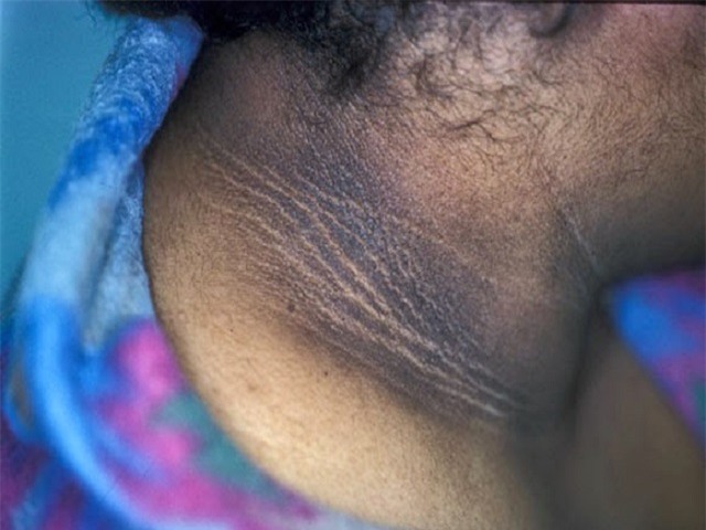 8 dấu hiệu sớm của bệnh tiểu đường: Bạn nên đi khám trước khi quá muộn  - Ảnh 3.