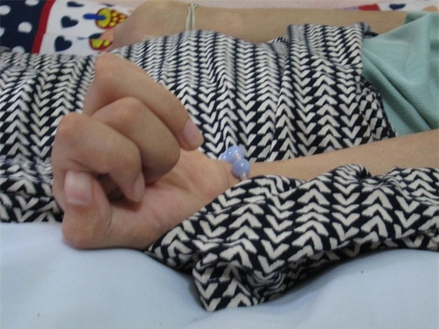 Đôi chân, tay nạn nhân Lệ đều bị co quắp dù có người thường xuyên chăm sóc và giúp vận động.