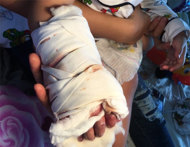 Be trai bi thang cuon o san bay Tan Son Nhat duoc mo noi gan tay hinh anh 1