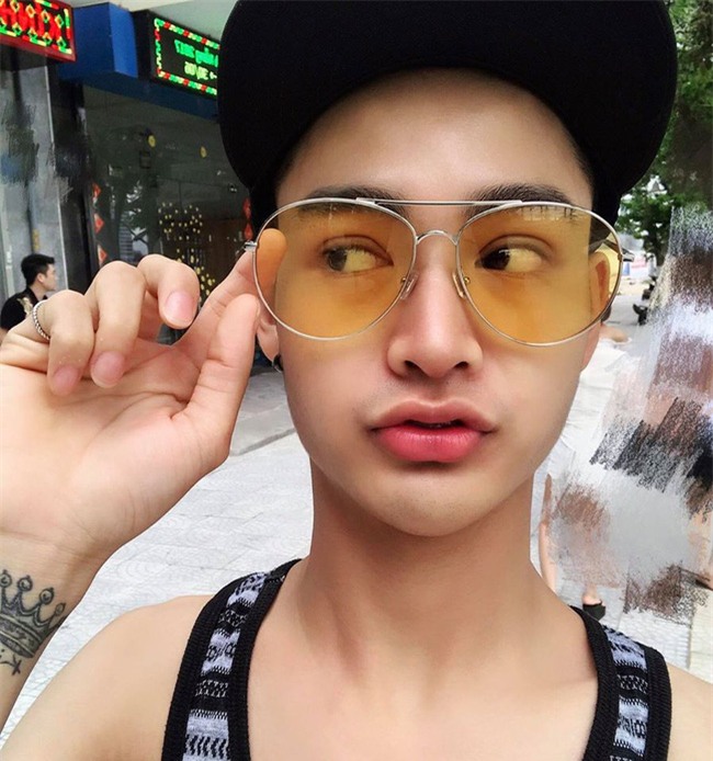 Chàng trai gây sốc khi công khai quá trình thẩm mỹ đau đớn, sửa, sửa nữa, sửa mãi vì tự ti - Ảnh 8.