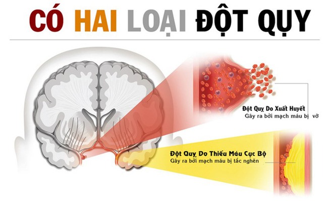 Ngay cả khi còn trẻ, hãy làm ngay 3 điều sau để phòng tránh cái chết đột ngột - Ảnh 2.