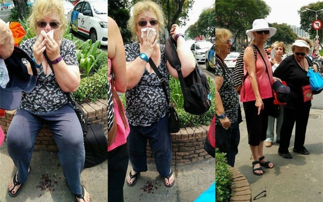 Hình ảnh nữ du khách bị vấp móc sắt trên vỉa hè dẫn đến bị thương