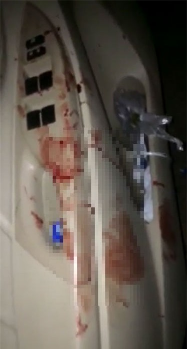 Máu vương khắp trong xe taxi bị nạn