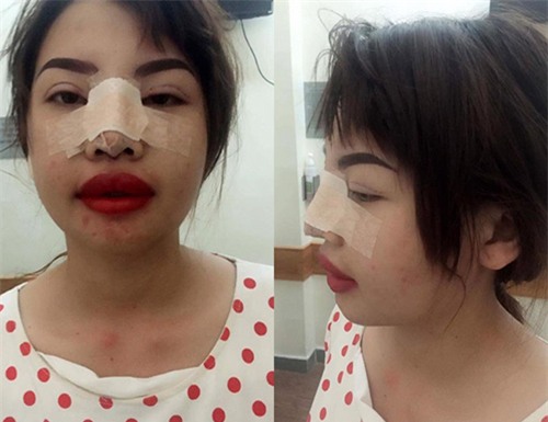 co gai dak nong tung khon kho vi bi che xau nay da lot xac ngoan muc sau 1 thang - 2