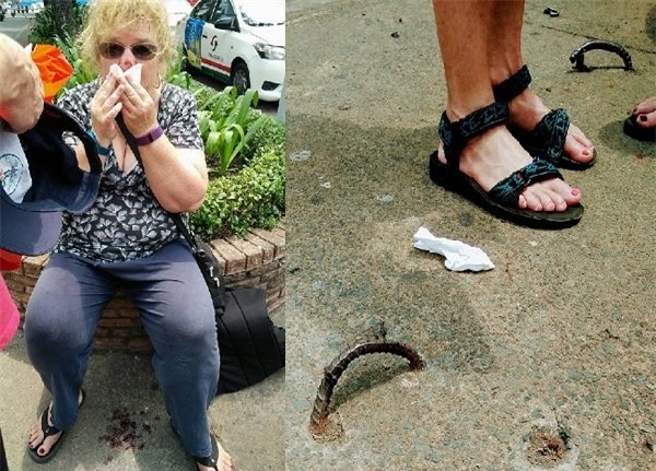 Quận 1, Đoàn Ngọc Hải, móc sắt, du khách ngã vỡ mặt, bẫy trên phố, đường Lê Lợi, bồi thường du khách