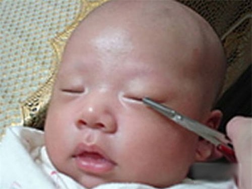 nguoi me soc nang khi biet nguyen nhan mat con nho sung hup, chay mu - 2