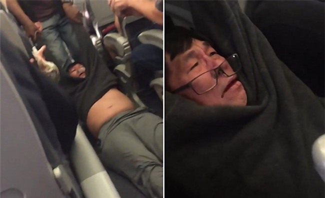 Be boi United Airlines: Ong David Dao co pham luat khong? hinh anh 1