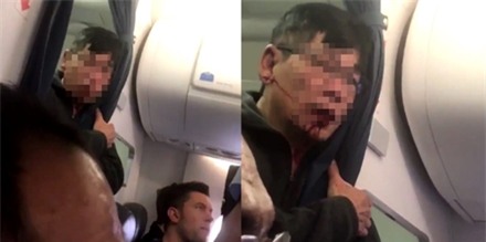 Nhà Trắng lên tiếng về scandal kéo lê khách của United Airlines ảnh 1