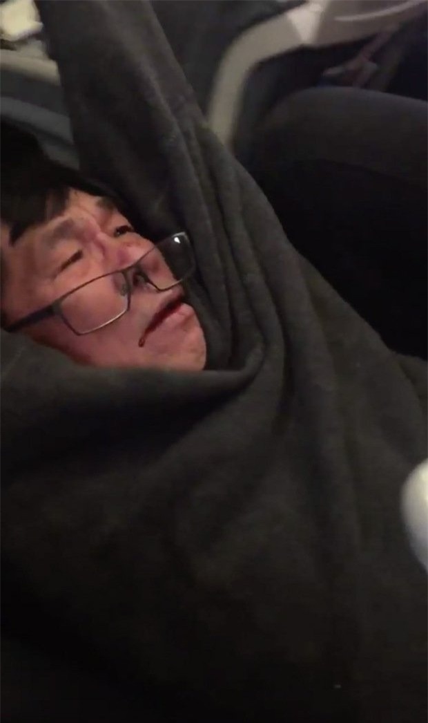 bác sĩ gốc Việt, bác sĩ bị lôi khỏi máy bay, khách gốc Việt bị lôi khỏi máy bay, United Airlines, David Dao