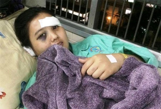 Bo Cong an vao cuoc vu thieu nu bi cat tai o Sai Gon hinh anh 1