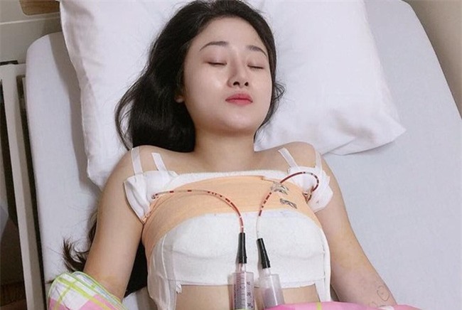 9X tốn gần 60 triệu đồng nâng cấp vòng một chảy xệ sau sinh - Ảnh 1.