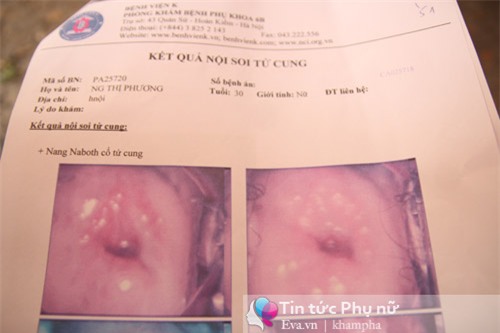 "co" long hanh o bv k trung uong, truc loi tren moi benh nhan hang tram den hang trieu dong - 8