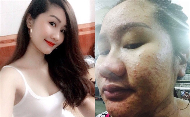 Khó nhận ra bà bầu từng trăn trở vì ngoại hình xấu xí cách đây hơn nửa năm - Ảnh 1.