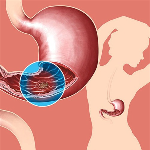 nhom mau tiet lo nguy co benh tat cua ban - 2