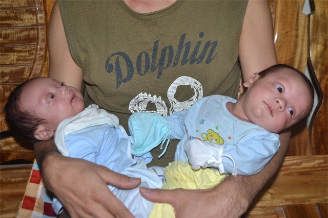 chuyen xuc dong ve ca sinh 3 dac biet hy huu o hai duong - 4