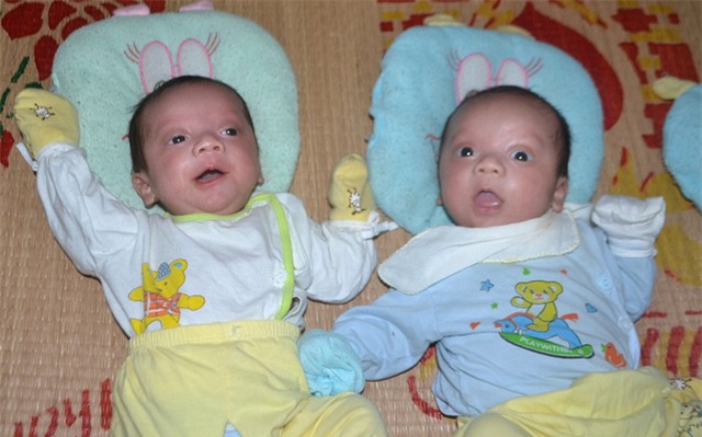 chuyen xuc dong ve ca sinh 3 dac biet hy huu o hai duong - 6