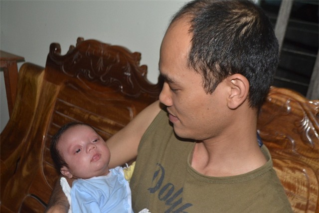 chuyen xuc dong ve ca sinh 3 dac biet hy huu o hai duong - 8