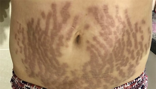 Me mot con ton 40 trieu dong de tim lai vong eo con kien hinh anh 1