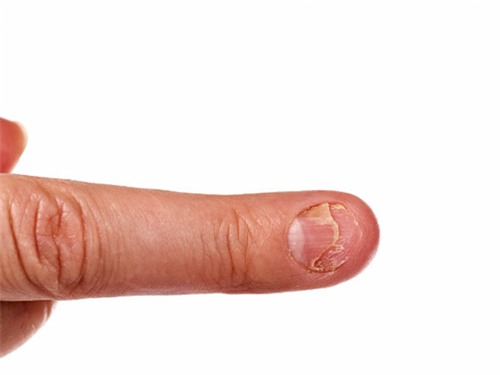 nhin mau sac mong tay, mong chan, doan benh 'chuan khong can chinh' - 2