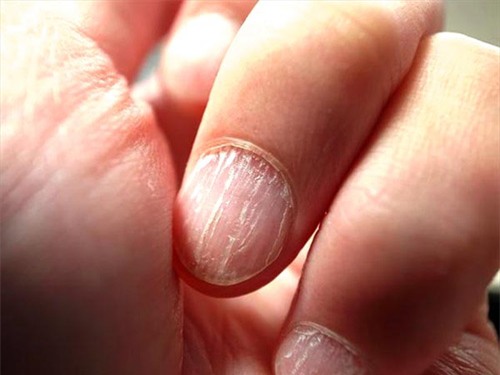 nhin mau sac mong tay, mong chan, doan benh 'chuan khong can chinh' - 5