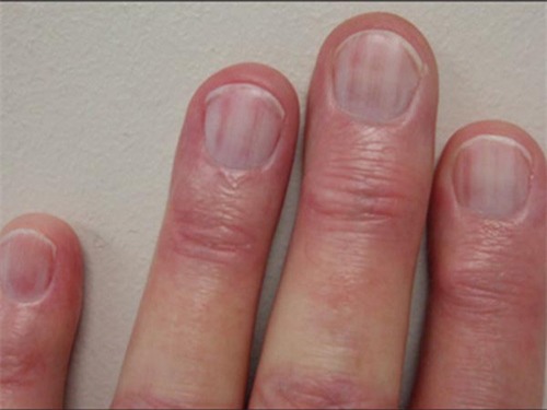 nhin mau sac mong tay, mong chan, doan benh 'chuan khong can chinh' - 7