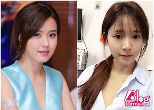 midu blogtamsuvn (15)