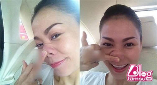 midu blogtamsuvn (17)