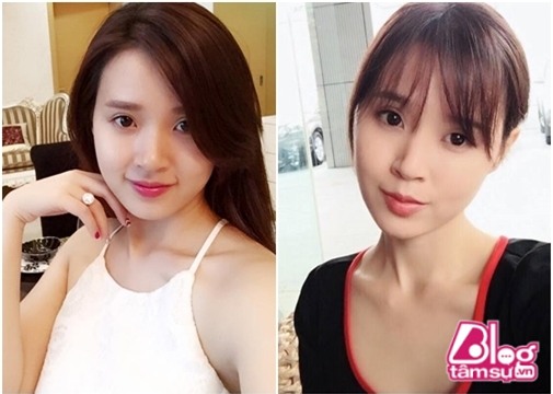 midu blogtamsuvn (14)