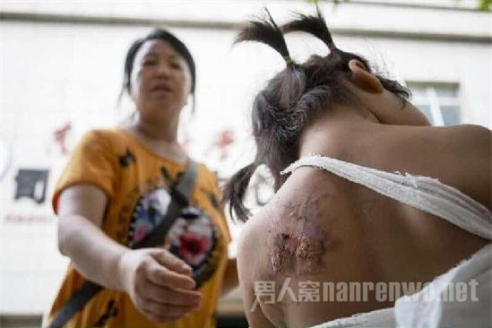 Bé gái 2 tuổi tử vong vì bị mợ phun nước nóng vào người sau khi tè dầm - Ảnh 1.