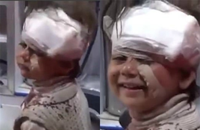 Dân mạng bật khóc trước clip cô bé Syria mặt rớm máu vẫn mỉm cười - Ảnh 1.