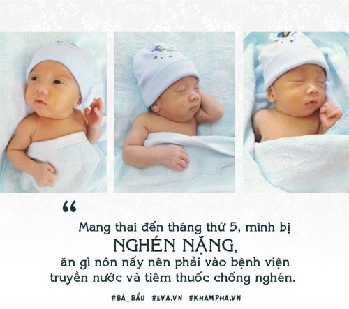 me tre ha noi mang thai 3 hiem gap ma ca the gioi 200 trieu ca moi co mot - 4