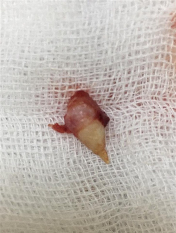 Rang moc trong mui cua be gai 4 tuoi hinh anh 1