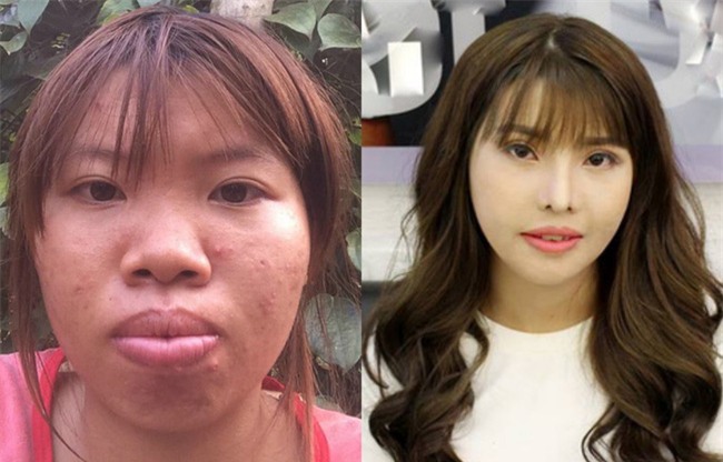 Lời chua xót của cô gái vì xấu xí nên không xin được việc, chẳng có ai yêu, chỉ muốn tự tử gây sốt mạng - Ảnh 5.