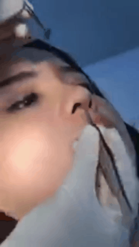 Thái Trinh để livestream phẫu thuật thẩm mỹ, lột xác hoàn toàn sau nâng mũi và cắt mí - Ảnh 3.