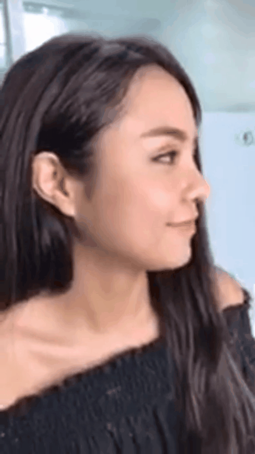 Thái Trinh để livestream phẫu thuật thẩm mỹ, lột xác hoàn toàn sau nâng mũi và cắt mí - Ảnh 6.