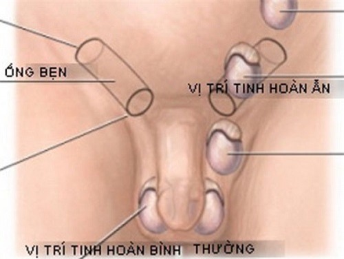 nhieu tre bien thanh “thai giam” vi bo me chu quan voi bo phan sinh duc cua con - 1