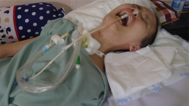 Từ 1 người phụ nữ tháo vát, giỏi giang, Lệ trở nên tàn phế sau vụ nổ tại Văn Phú, Hà Đông hồi tháng 3/2016.