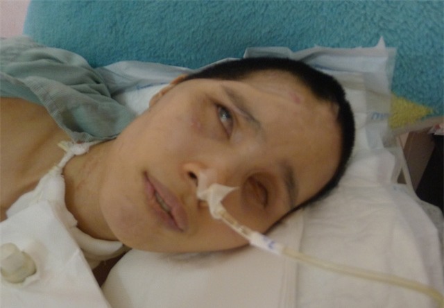 Hai mắt của em đã hỏng hoàn toàn, 1 bên não bị mất...